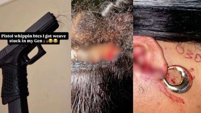 Instagram Post About Hair Stuck in Gun Muzzle Links Detroit Man to Royal Oak Pistol-Whipping, FBI Says